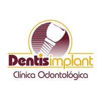 Clinica Dentis Implant